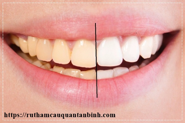 c&aacute;ch l&agrave;m trắng răng bằng baking soda với kem đ&aacute;nh răng